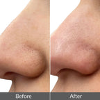 Ultrasonic Facial Skin Scrubber for Cleansing & Exfoliation