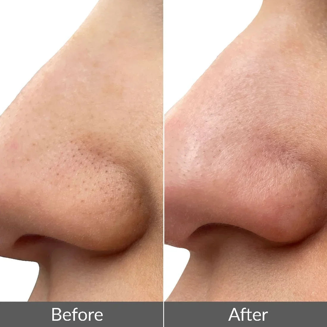 Ultrasonic Facial Skin Scrubber for Cleansing & Exfoliation